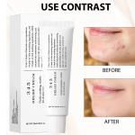 Καταπραϋντική κρέμα-τζελ προσώπου 50ml      Dr. Althea - Image 2